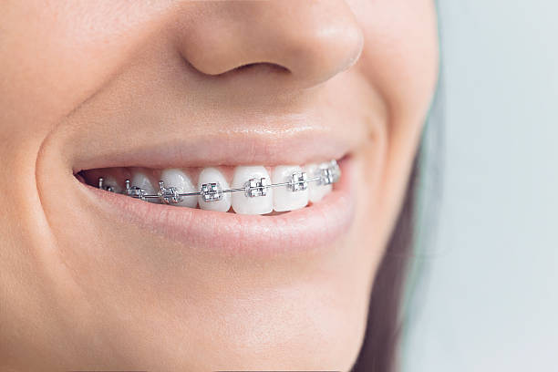 Best Traditional Braces  in Whitehall, MI